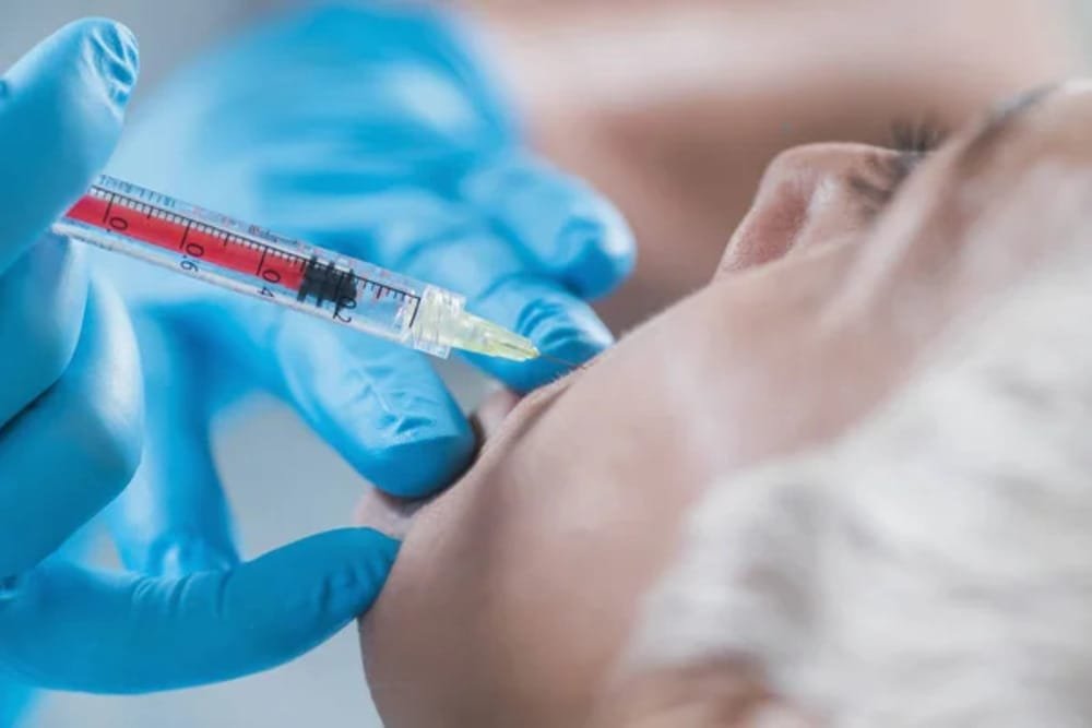 Vampire Facials Small 1